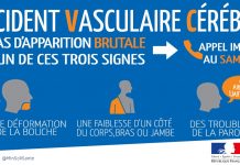 Reconnaître les signes de d'un AVC pour une prise en charge rapide