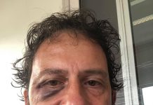 Un journaliste de Kwezi passé à tabac à Maurice