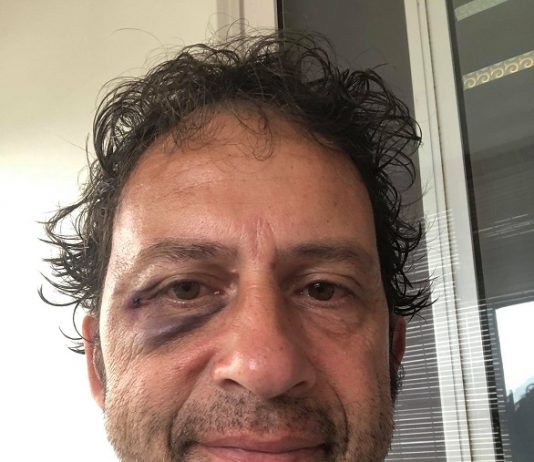 Un journaliste de Kwezi passé à tabac à Maurice