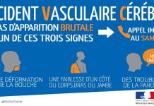 AVC : 273 cas en 2018 à Mayotte