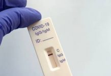 L’ARS Mayotte déploie 20.000 tests à destination des Comores pour enrayer une nouvelle vague régionale Comores, ARS, Mayotte