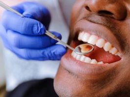 Santé – Mise en place d’une permanence d’urgence de soins dentaires à Mayotte Dentistes, Mayotte, ARS